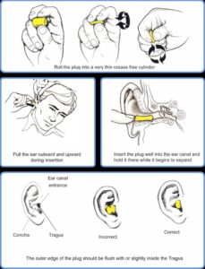 Remove Ear Plug Hearing Protection - Tinnitus Association